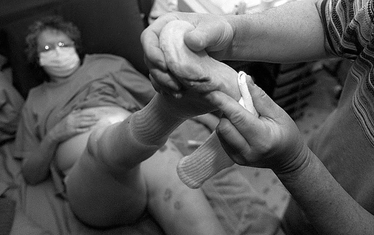 Diabeties story, dialysis, kidney donation transplant-New Jersey Editorial Photographer
